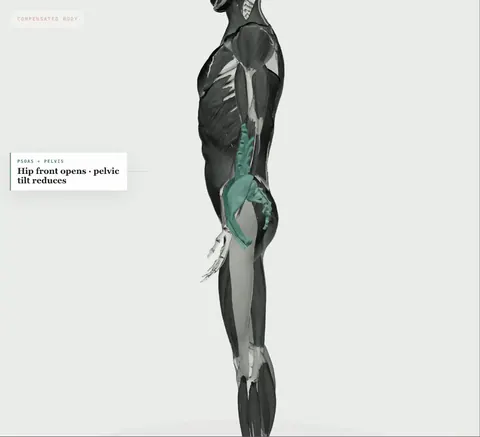 A study from the book: the body from the side, the pelvis rebuilt toward level