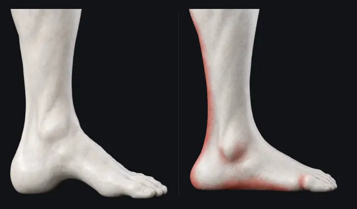 Two marble statues' feet from the inside. Left: a clear arch lifts off the floor. Right: the arch has flattened to the floor, the inner ankle bone rolls in, and the sole, heel and back of the ankle glow a dimmer red (asleep).